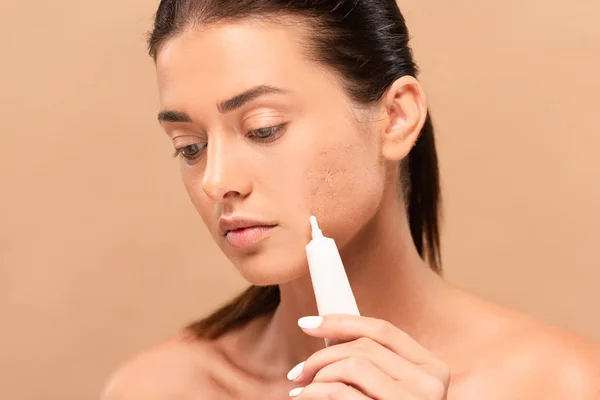 Naked girl holding treatment cream near face with problem skin isolated on beige — Stock Photo