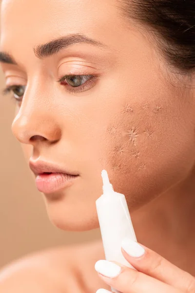 Primer plano de la niña sosteniendo crema de tratamiento cerca de la cara con la piel problema aislado en beige - foto de stock