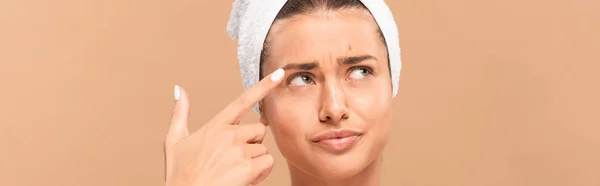 Panoramic shot of displeased woman pointing with finger at face with pimple isolated on beige — Stock Photo