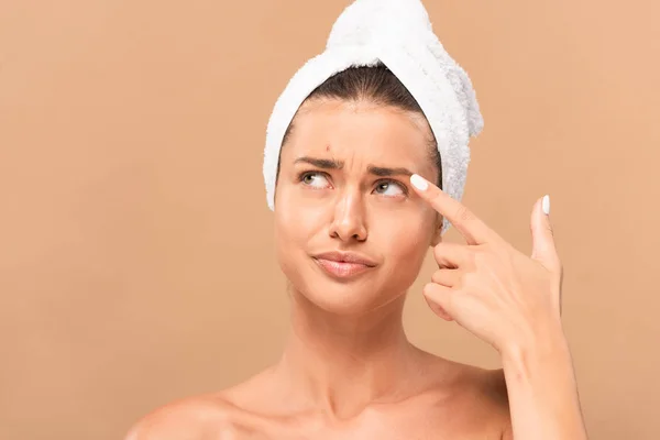 Displeased woman pointing with finger at face with pimple isolated on beige — Stock Photo