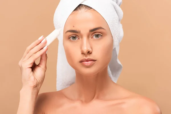 Fille nue en serviette tenant crème de traitement près du visage avec la peau de problème isolé sur beige — Photo de stock