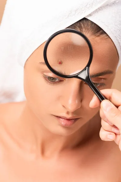 Cropped view of man holding magnifier near woman with pimple on face — Stock Photo