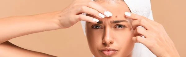 Panoramic shot of young woman in towel squeezing pimple isolated on beige — Stock Photo