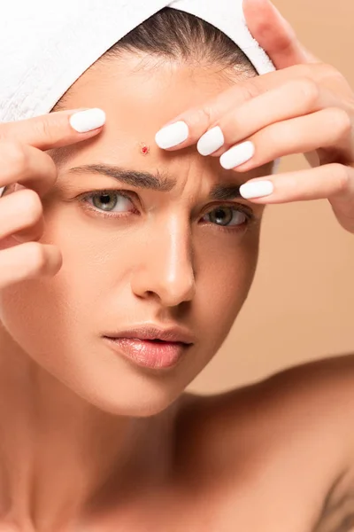 Young woman in towel touching face with pimple isolated on beige — Stock Photo