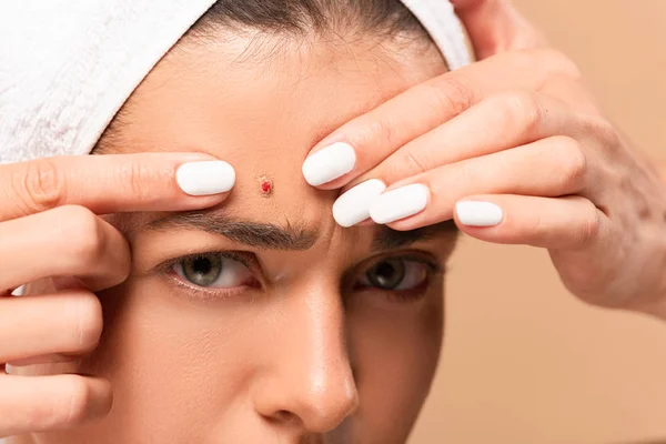 Cropped view of young woman in towel squeezing pimple isolated on beige — Stock Photo