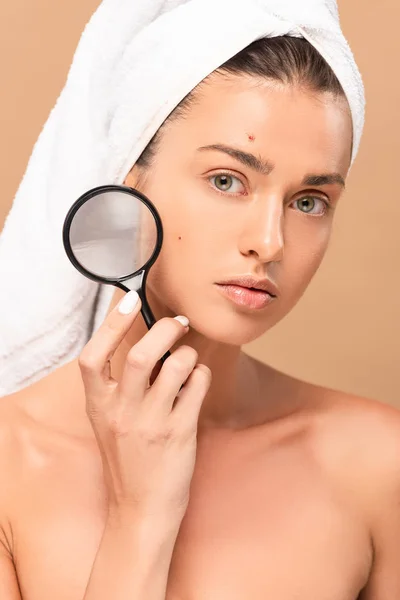 Nude woman with pimples on face holding magnifier isolated on beige — Stock Photo