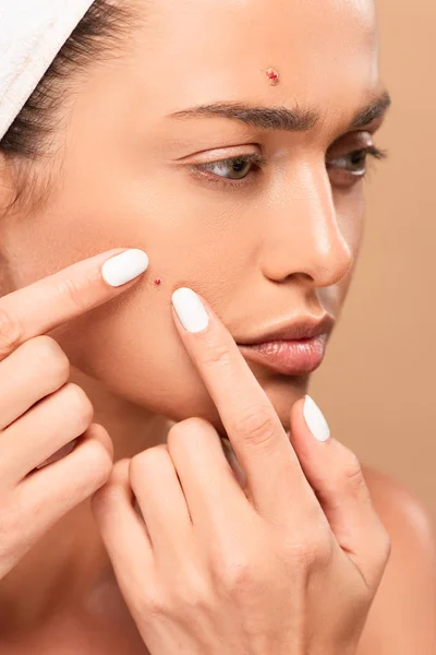 Attractive woman squeezing pimples isolated on beige — Stock Photo