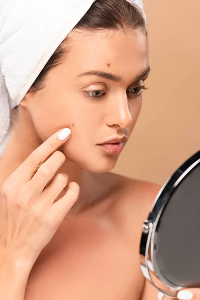 Naked girl in towel touching face with pimples and looking at mirror isolated on beige — Stock Photo