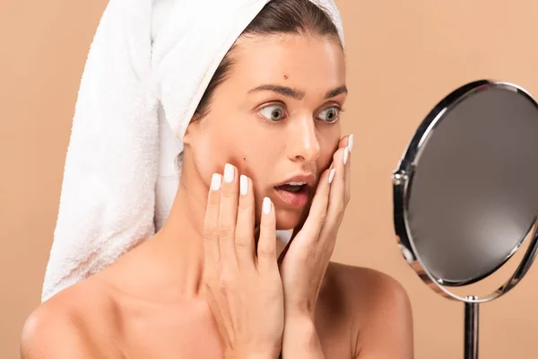 Surprised naked girl touching face with pimples and looking at mirror isolated on beige — Stock Photo