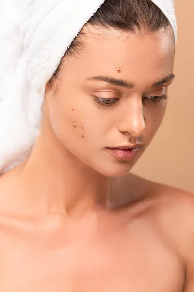 Naked girl with pimples on face isolated on beige — Stock Photo