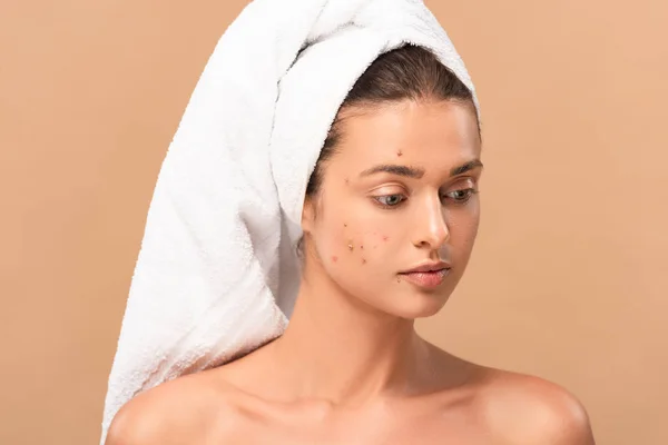 Naked girl in towel with acne on face isolated on beige — Stock Photo