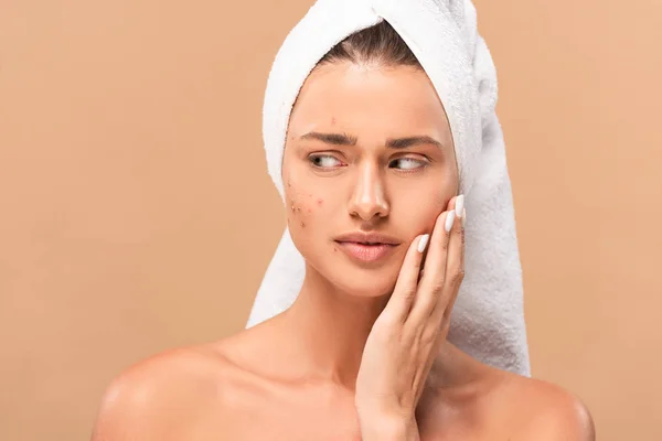 Ragazza nuda in asciugamano toccare il viso con l'acne e guardando lontano isolato sul beige — Foto stock