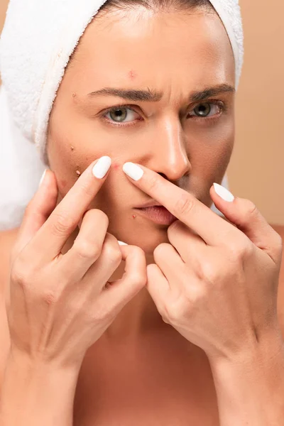 Young woman in towel squeezing pimples isolated on beige — Stock Photo