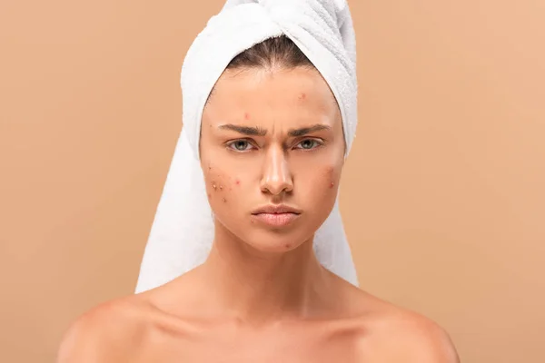 Displeased nude girl in towel looking at camera isolated on beige — Stock Photo