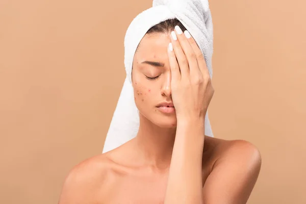 Nude girl with acne covering face isolated on beige — Stock Photo