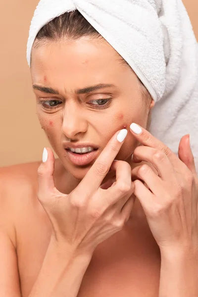 Displeased girl in towel squeezing pimple isolated on beige — Stock Photo