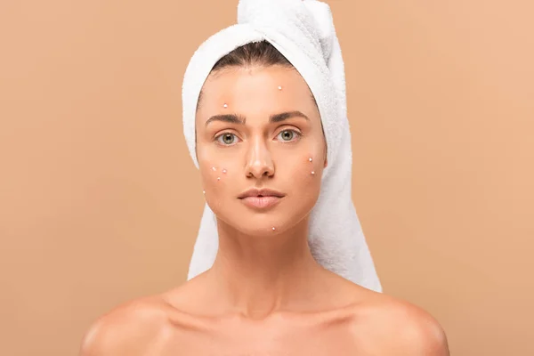 Young naked woman with pimples on face looking at camera isolated on beige — Stock Photo