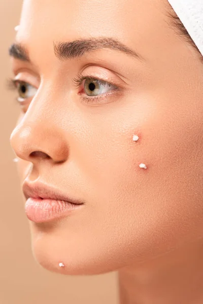 Close up of woman with acne on face isolated on beige — Stock Photo