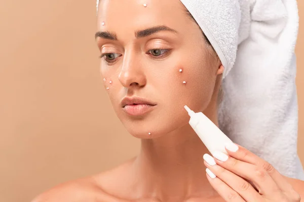 Nude girl with acne on face holding treatment cream isolated on beige — Stock Photo