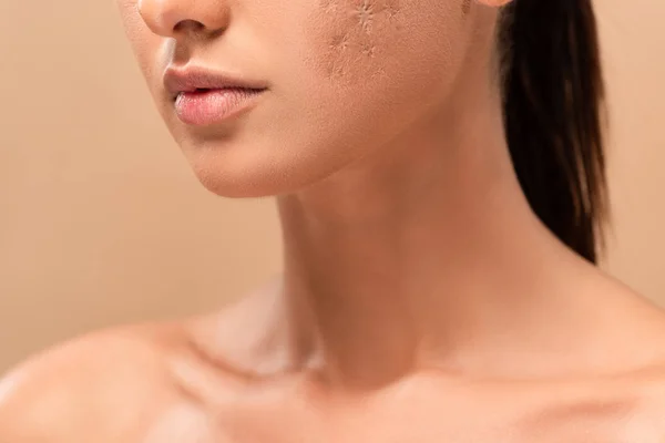 Vista cortada de jovem mulher nua com pele manchada isolado no bege — Fotografia de Stock