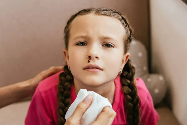 Mother holding napkin near daughters nose with blood — Stock Photo