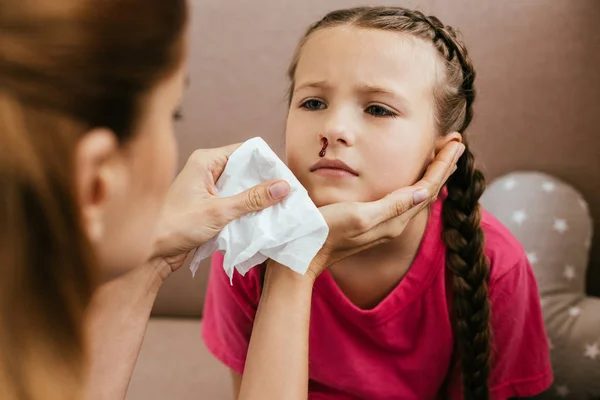 Vista recortada de la madre sosteniendo la servilleta cerca de la hija con hemorragia nasal - foto de stock