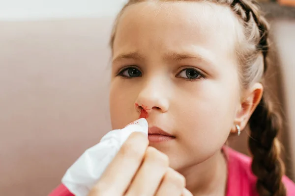 Mom holding napkin near daughter with nasal bleeding — Stock Photo