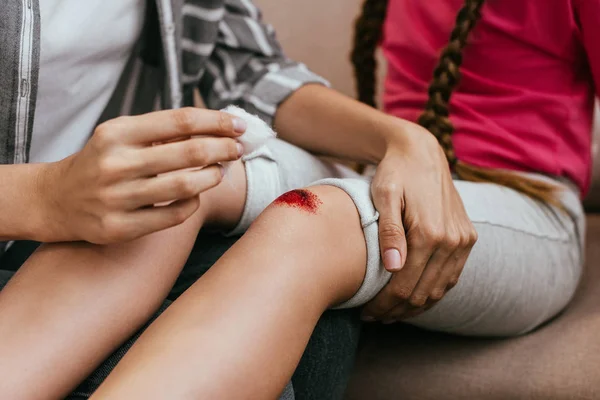 Vista recortada de la madre sosteniendo algodón antiséptico cerca de la herida en la rodilla de la hija - foto de stock