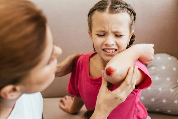 Worried mother looking at bloody elbow of crying daughter — Stock Photo