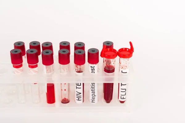Tubos de ensaio com amostras de sangue e letras isoladas a branco — Fotografia de Stock