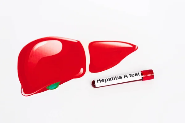 Muestra con hepatitis una inscripción de prueba cerca del hígado extraído aislado en blanco - foto de stock