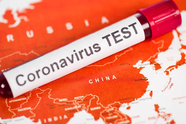 Primer plano de la muestra con letras de prueba de coronavirus en el mapa - foto de stock