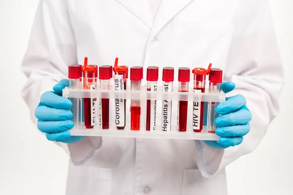 Cropped view of scientist in latex gloves holding samples with lettering isolated on white — Stock Photo