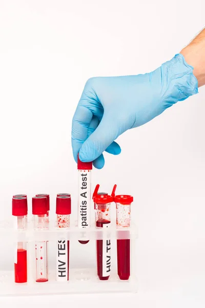 Vista cortada do cientista em luva de látex azul segurando amostra com hepatite um teste de letras isoladas em branco — Fotografia de Stock