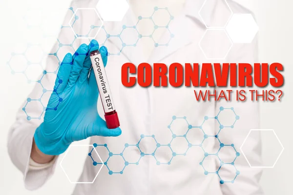 Cropped view of scientist holding sample with blood and coronavirus test near coronavirus what is this lettering on white — Stock Photo