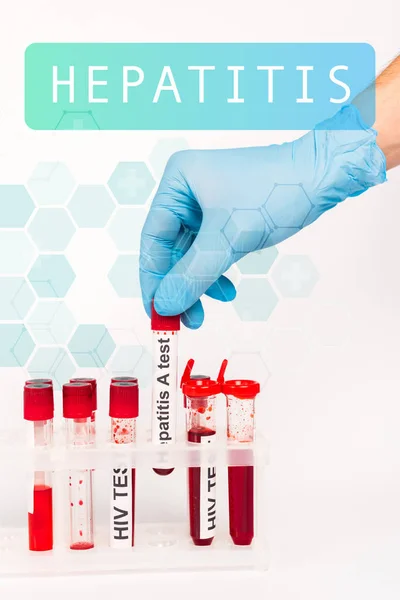Cropped view of scientist in blue latex glove holding sample with hepatitis a test near hepatitis lettering on white — Stock Photo