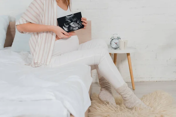 Cropped view of pregnant woman holding ultrasound scan of baby while sitting on bed — Stock Photo