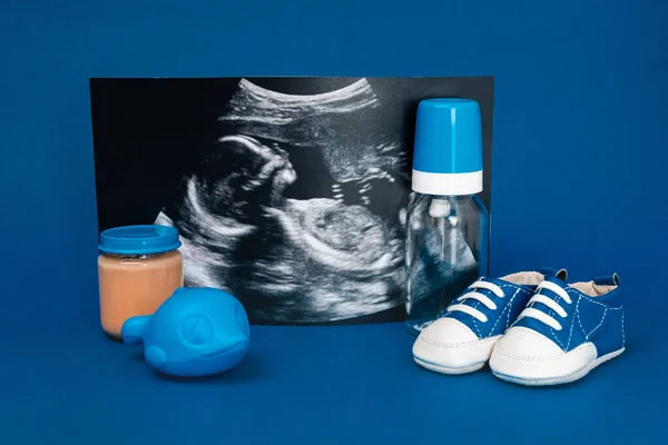 Ultrasound scan, baby bottle, toy, baby shoes, jar with baby food ob blue background — Stock Photo