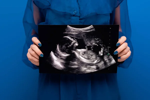 Vue recadrée de la femme tenant une échographie isolée sur bleu — Photo de stock