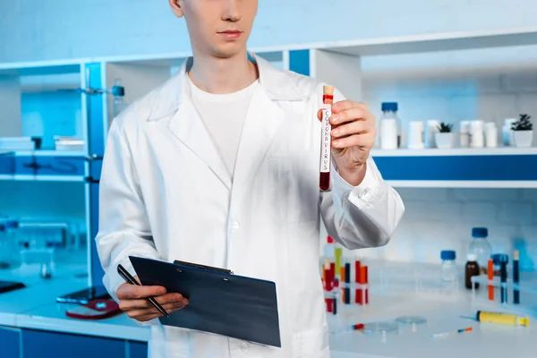 Vista recortada del científico que sostiene el tubo de ensayo con letras de coronavirus y portapapeles - foto de stock