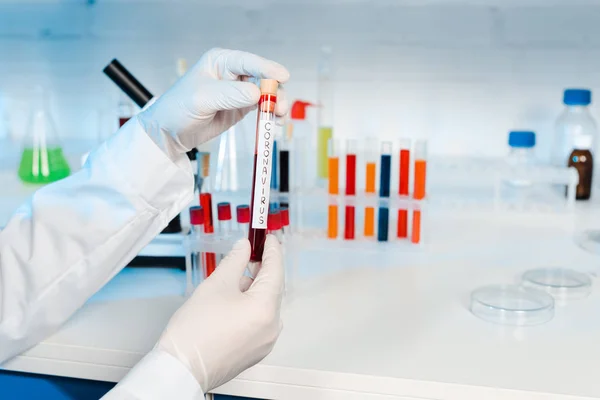 Cropped view of scientist in latex gloves holding sample with coronavirus lettering — Stock Photo