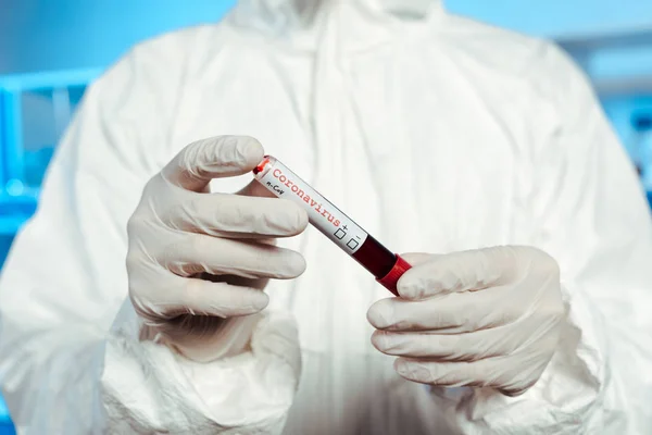 Selective focus of scientist in latex gloves holding sample with coronavirus lettering — Stock Photo