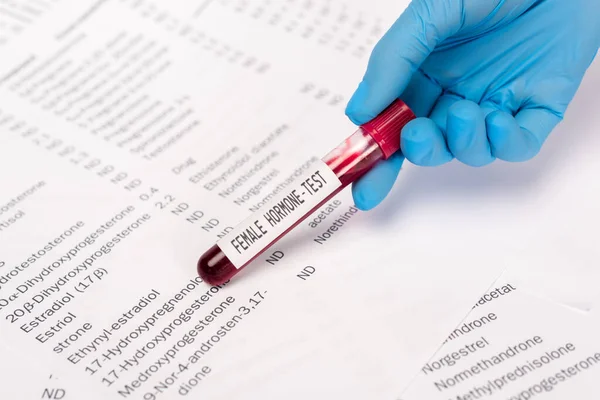 Cropped view of doctor holding test tube with sample of female hormone near lists with hormones — Stock Photo