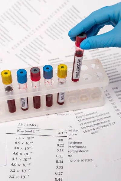 Cropped view of doctor holding test tube with female hormone test near stand and lists with hormones isolated on white — Stock Photo