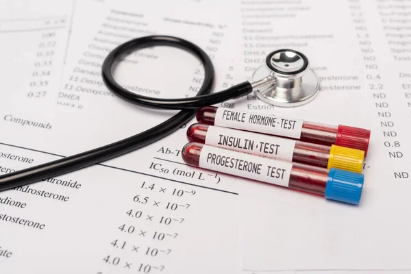 Close up view of test tubes with hormone and insulin tests of blood near stethoscope and lists with hormones — Stock Photo