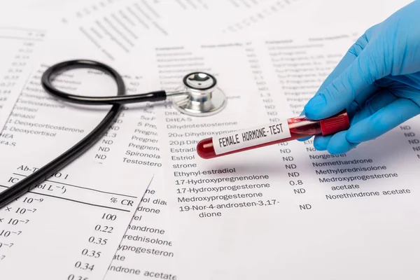 Cropped view of doctor holding test tube with female hormone test near stethoscope and lists with hormones — Stock Photo