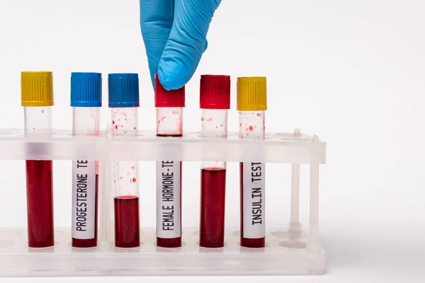 Vista cortada do médico segurando amostra de sangue de teste de hormônio feminino perto de tubos de teste em stand no fundo branco — Fotografia de Stock