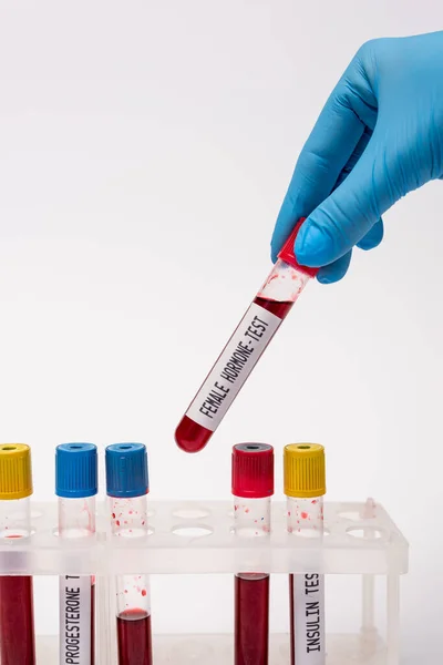 Vista recortada del médico sosteniendo el tubo de ensayo con prueba hormonal femenina cerca de muestras de sangre en soporte aislado en blanco - foto de stock