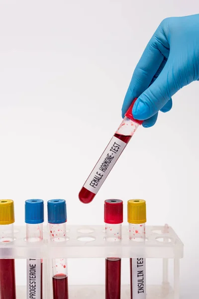 Cropped view of doctor holding test tube with female hormone test near blood samples in stand isolated on white — Stock Photo