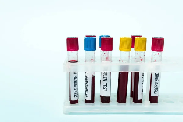 Test tubes with blood samples of insulin and hormones tests in stand isolated on blue — Stock Photo